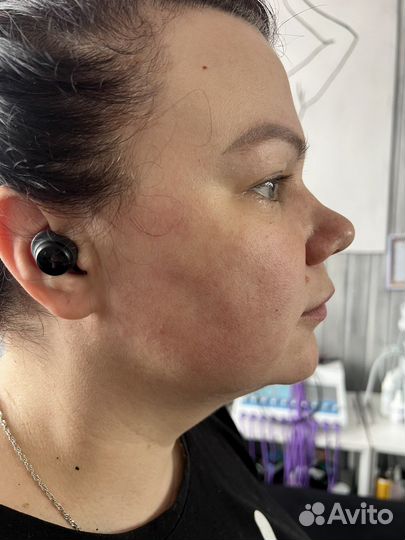 Точки голода, требуются модели, похудение