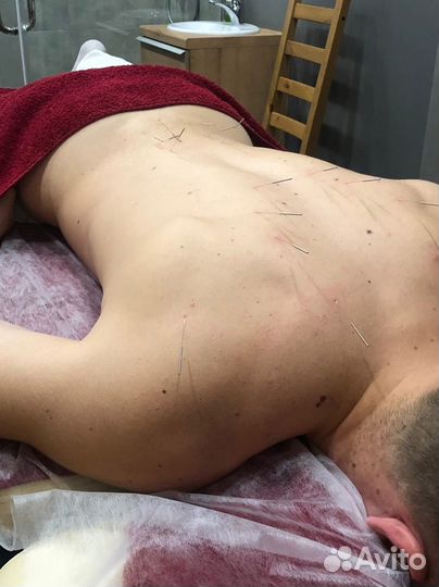 Мануальный массаж. Костоправ. Сильный массаж вмеда