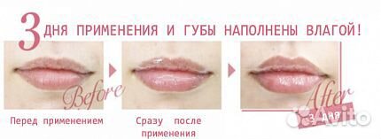 Премиальная Anti-age сыворотка для губ Ravissa