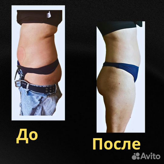 Коррекция фигуры. Аппаратный массаж. Похудение