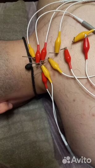 Мануальный терапевт