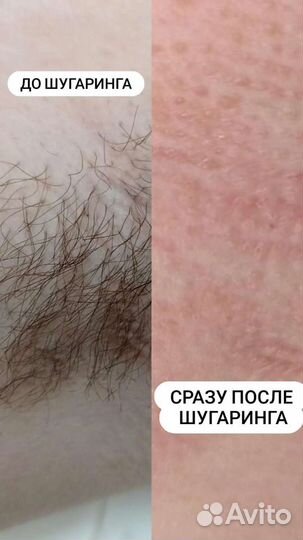 Шугаринг Мужской и женский