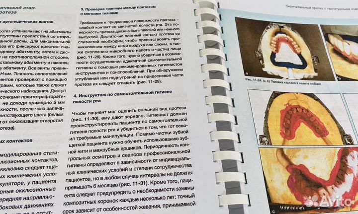 Имплантаты под наклоном