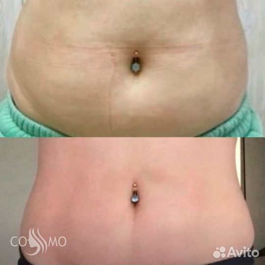 Ищем моделей на коррекцию фигуры