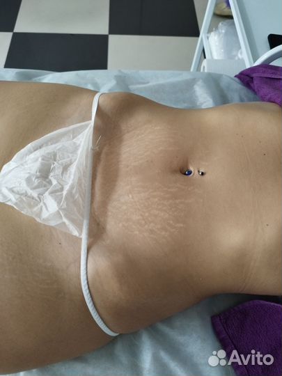 Антицеллюлитный массаж ручной