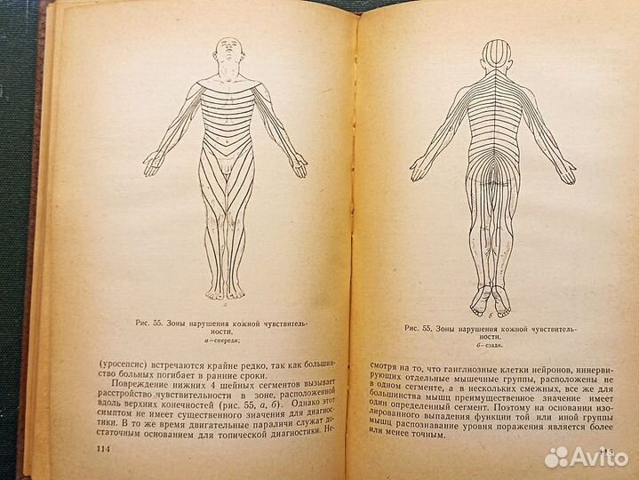 Клиника и лечение закрытых повреждений позвоночник