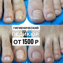 Подолог, Чебоксары