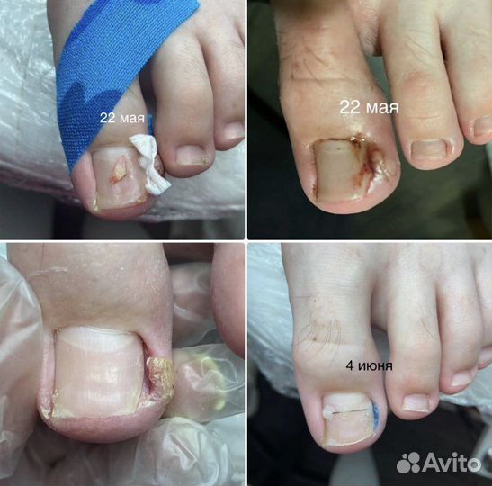 Услуги подолога