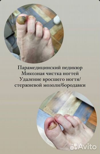 Услуги подолога