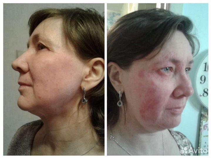 Висцеральный массаж живота по методу Огулова