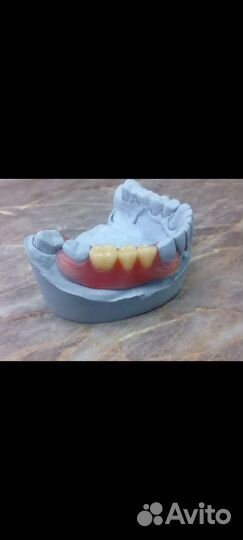 Зубной техник съемное протезирование