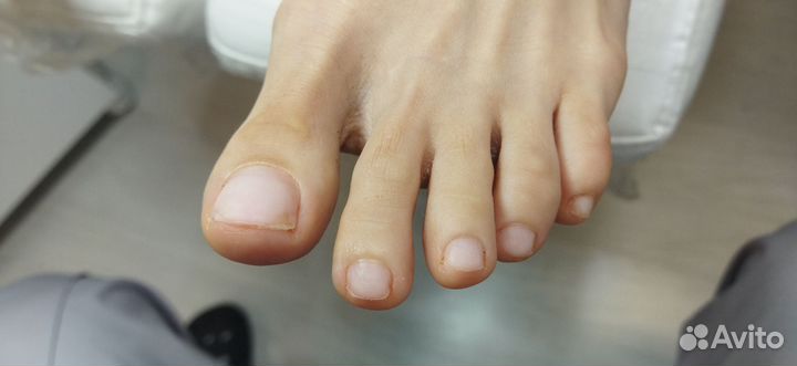 Педикюр лечебный, подолог, выезд на дом