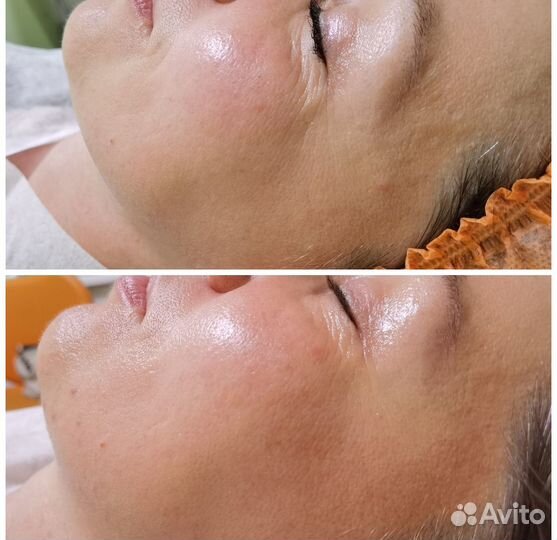 Косметолог,работа с проблемной и возрастной кожей