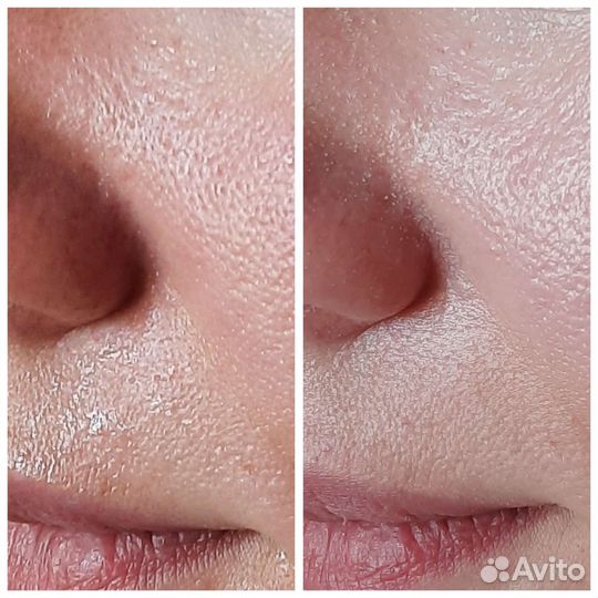 Услуги косметолога