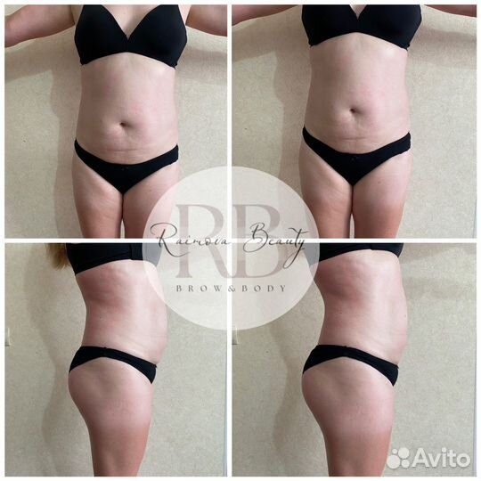 Экспресс-похудение ищу моделей