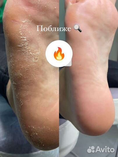 Педикюр с покрытием гель-лаком