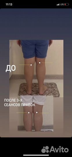 Устраняю боль, исправляю осанку