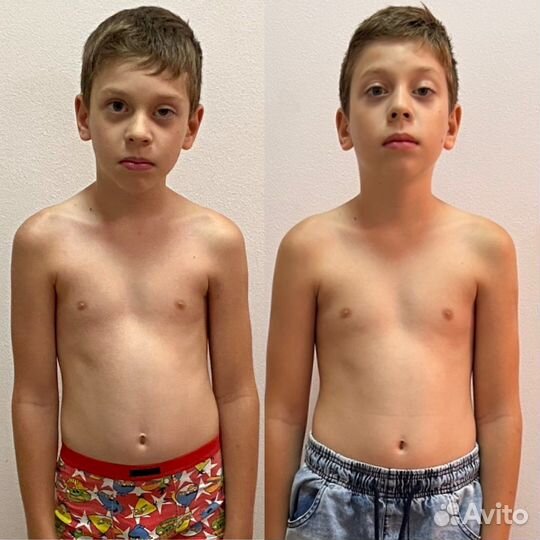 Обучение массажу Детский исправление осанки