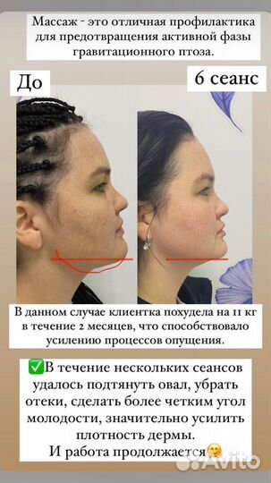 Массаж лица