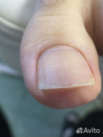 Педикюр подолог