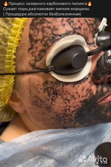 Косметология. Удаление тату/татуажа. Прессотерапия