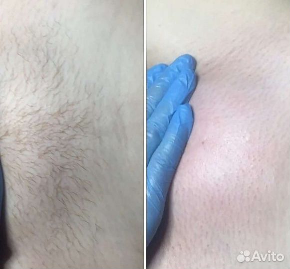 Мужская и женская депиляция воском и сахаром