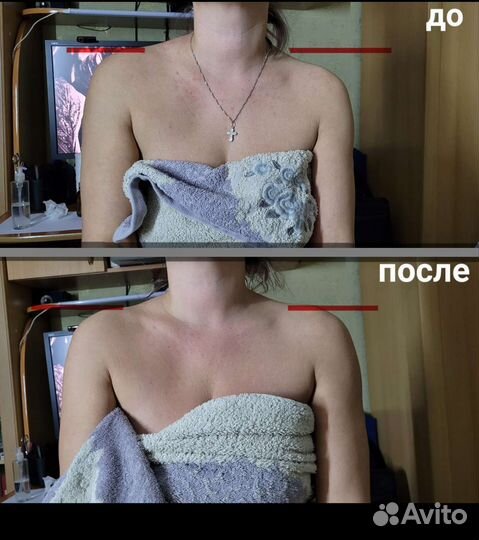 Услуги массажиста