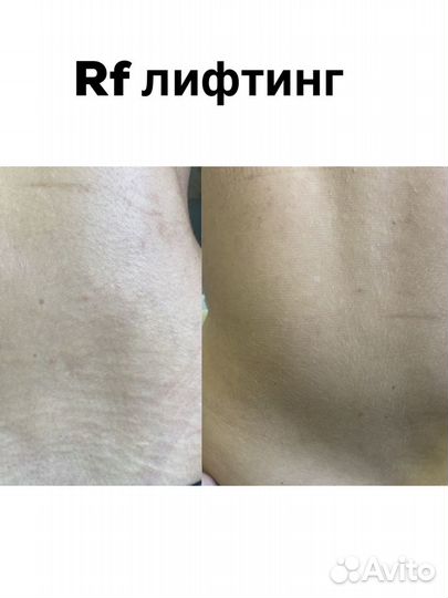 Эстетическая и Аппаратная косметология