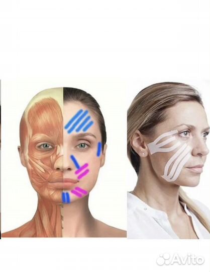 Тейпирование лица, омоложение, оздоровление