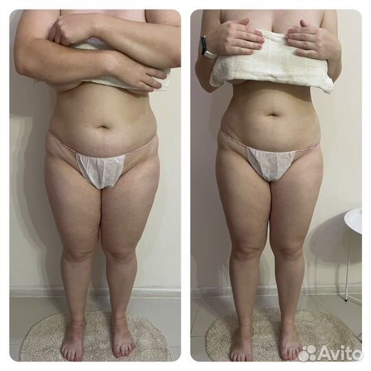 Аппаратный массаж