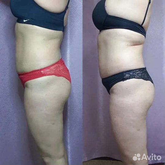 Аппаратный массаж Тело + Лицо