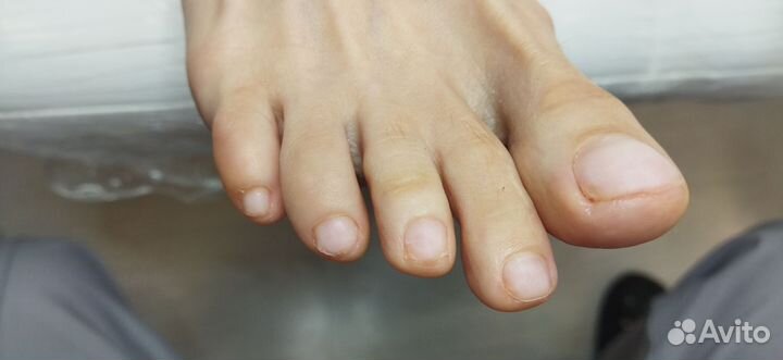 Педикюр лечебный, подолог, выезд на дом