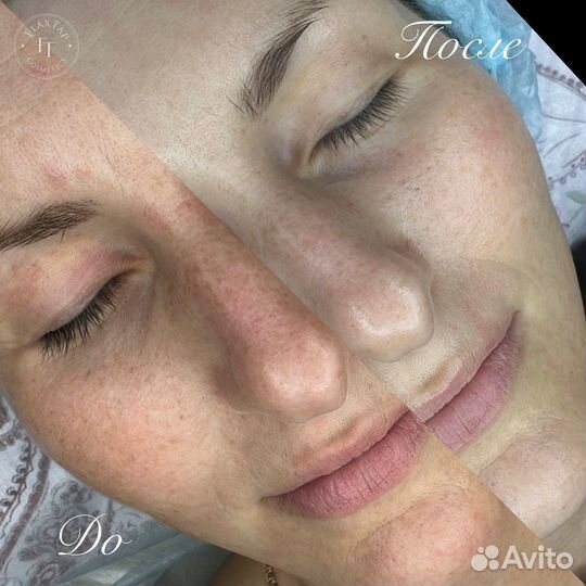 FlaxLift, FlaxSculpt, FlaxEnzyme