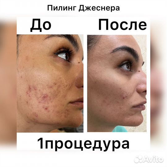 Мастер по наращиванию ресниц, косметолог