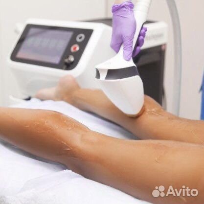 Лазерная элос эпиляция на тополинке
