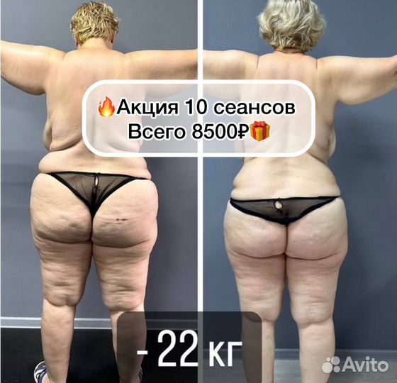 Аппаратный массаж. Антицеллюлитный. Коррекция фигу