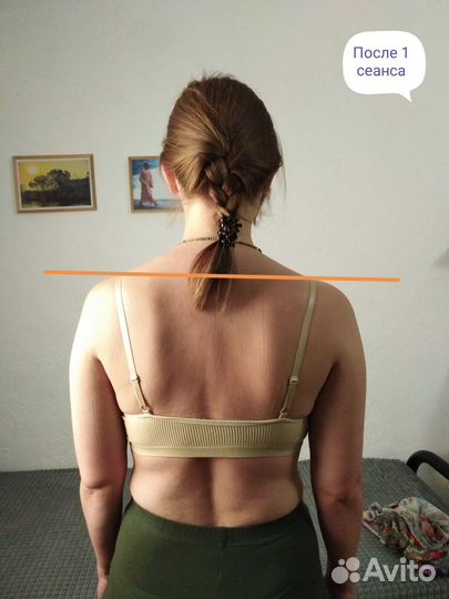 Остеопатия, коррекция позвоночника, остеогармония