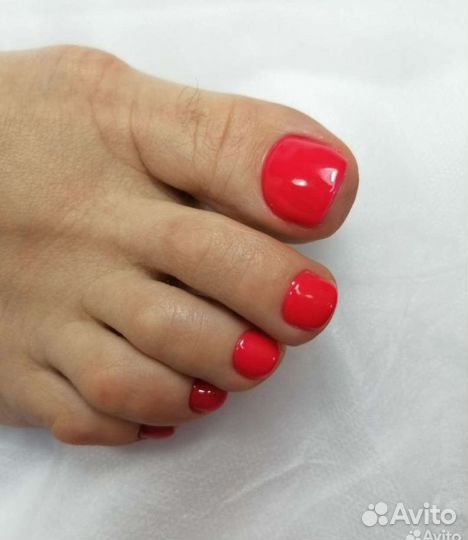 Коррекция вросшего ногтя, медицинский педикюр