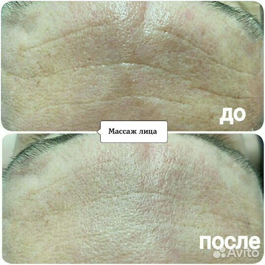 Моделирующий массаж лица + микротоки
