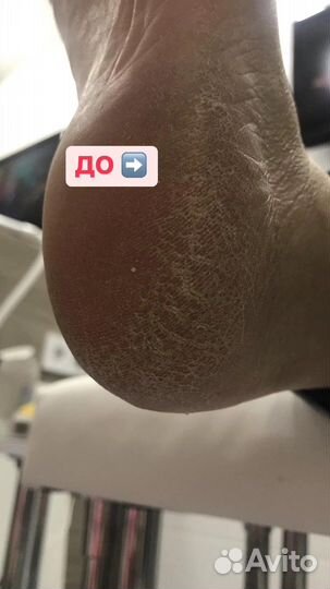 Идеальный Френч