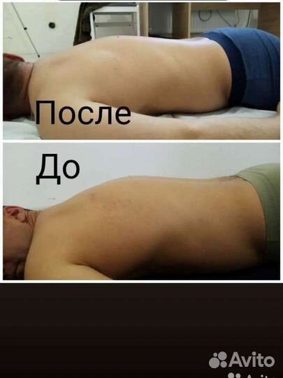 Костоправ массаж