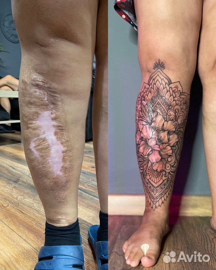 Мастер татуировки, перекрытие шрамов, тату в СПБ