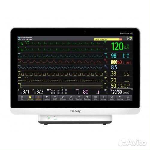 Монитор пациента Mindray BeneVision N17