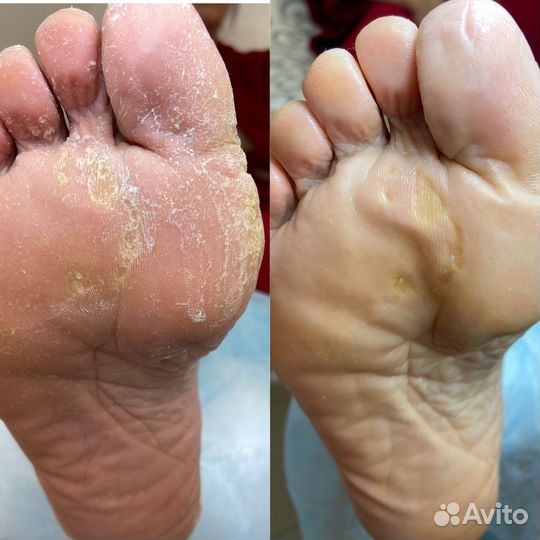 Услуги подолога