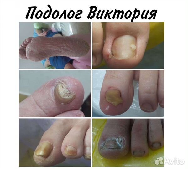 Услуги подолога