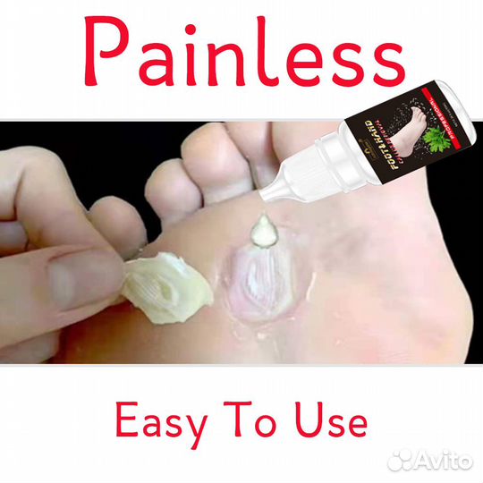 Средство для размягчения мозолей и нежных пяток