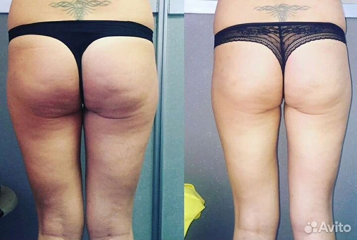 Массаж, спа