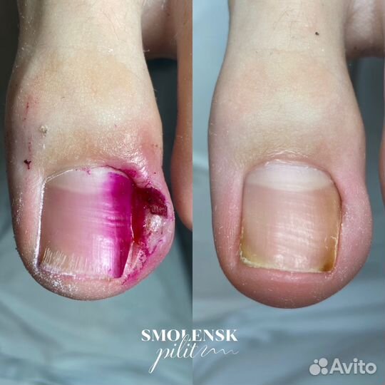 Услуги подолога