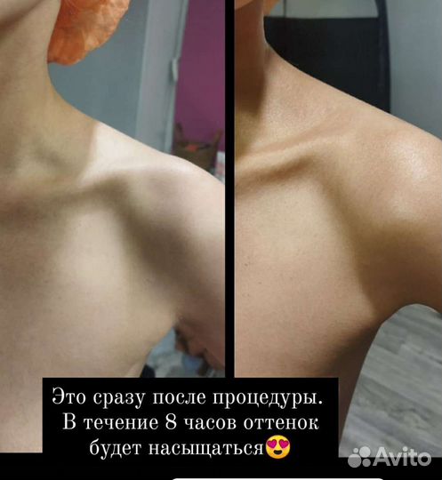 Моментальный загар