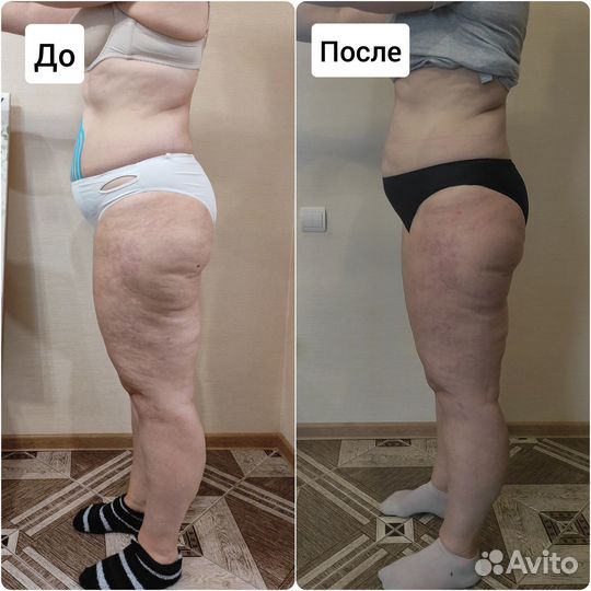 Массаж коррекции фигуры акция